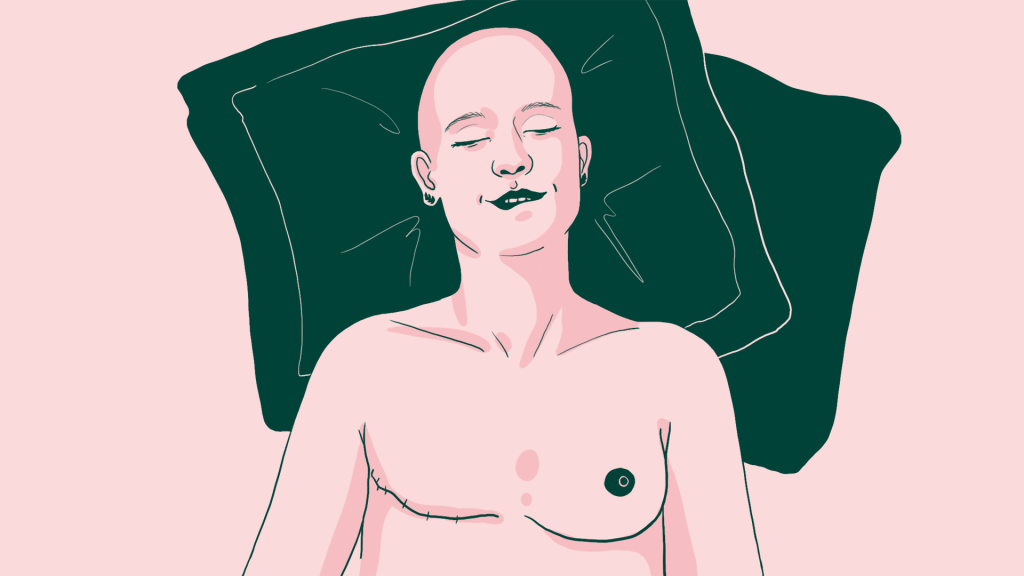Quelle vie sexuelle avec un cancer du sein ?